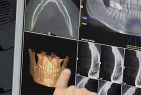 Röntgenaufnahmen des Kiefers und 3-D Simulation bei der Oralchirurgie in Berlin
